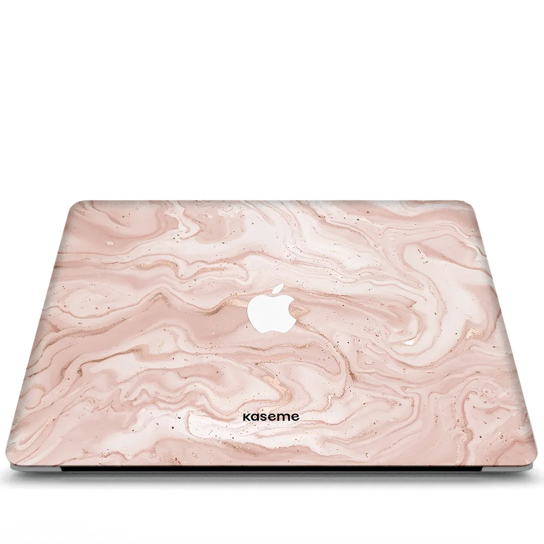 Midas Touch MacBook Skin